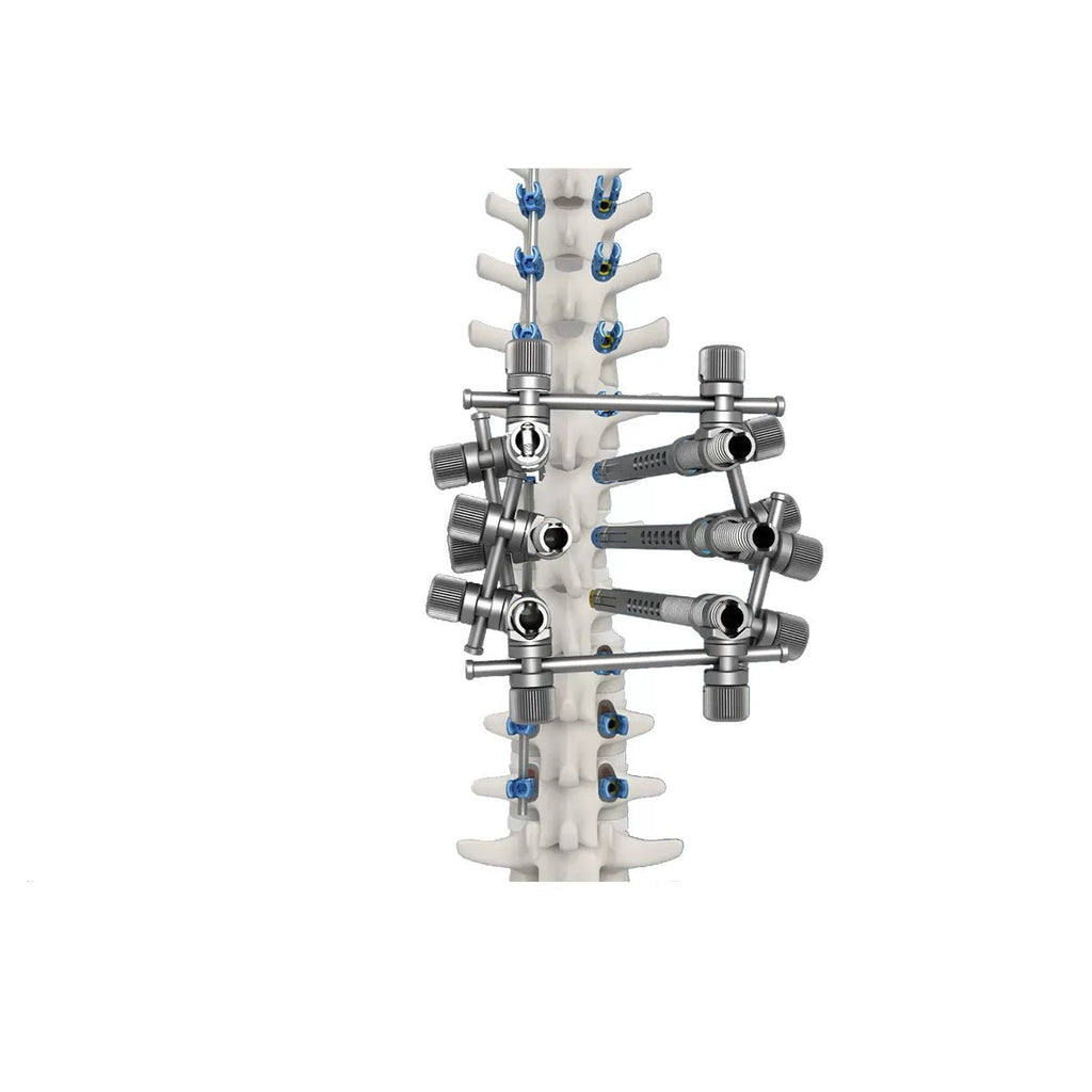 5.5 Spinal Deformity Correction Instrument Set
