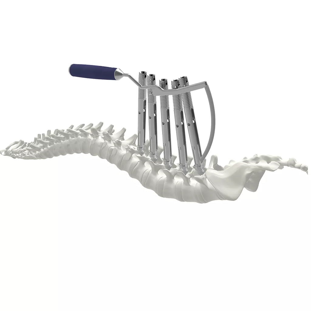 6.0/6.35 mm percutaneous TL screw-rod fixation Instruments (rigid)