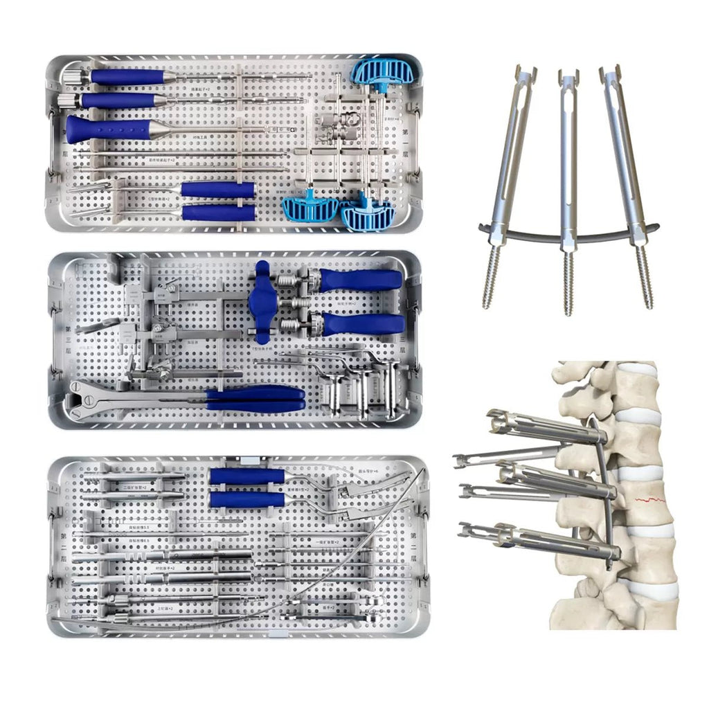 5.5mm Percutaneous MIS TL Extension Tab System