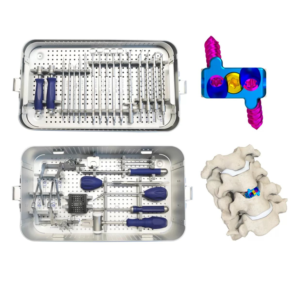 Zero Profile Interbody Fusion Cage Instrument Set( 2 Screws-II)