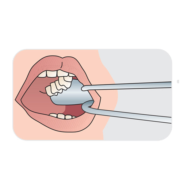 Bishop Cheek Retractor