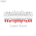 33 Root Extraction Forceps English Pattern