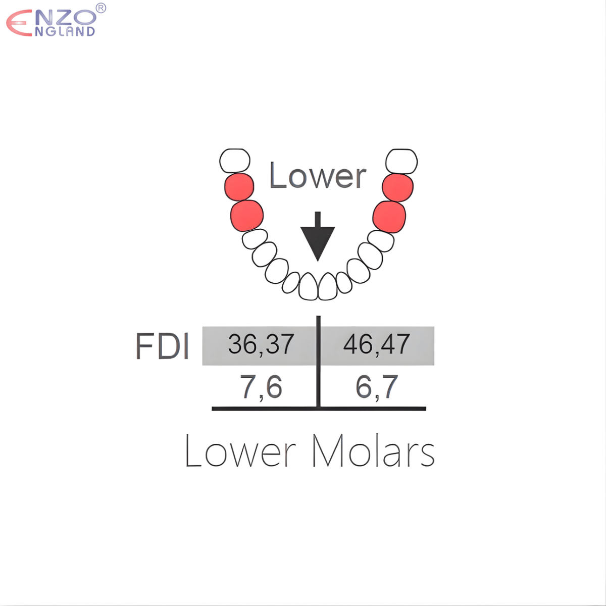 73 Extraction Forceps English Pattern