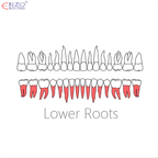 74N Root Extraction Forceps English Pattern